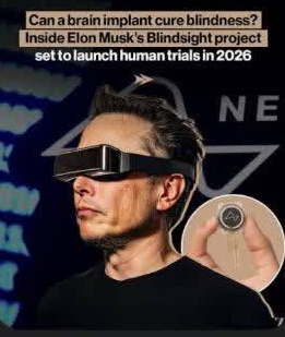 الکترودها و مغز